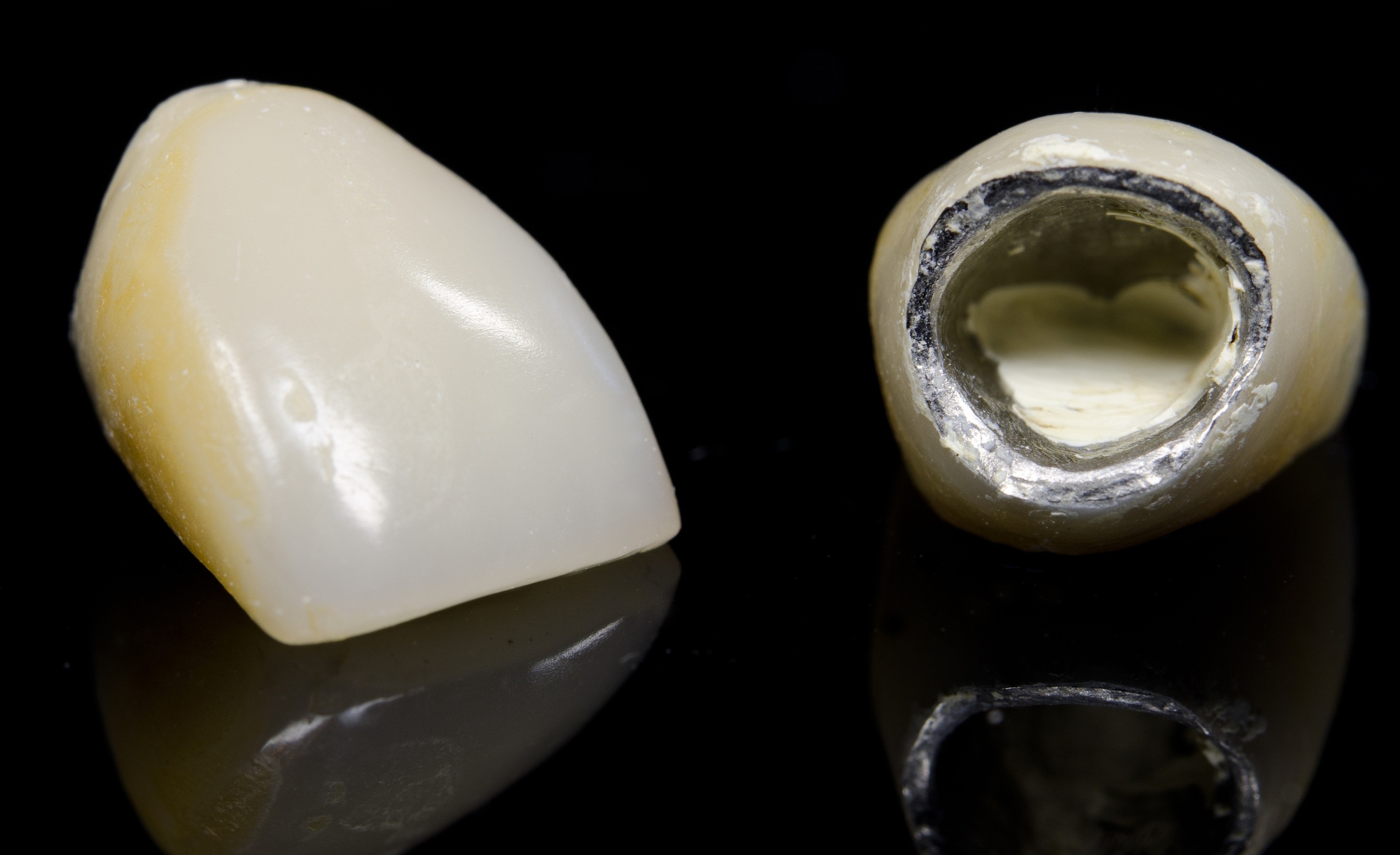 Как выглядят зубы из металлокерамики фото
